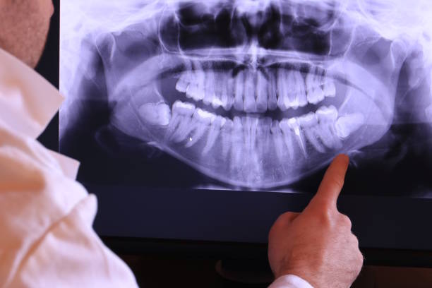 Best Emergency Treatment for Toothache in Horicon, WI