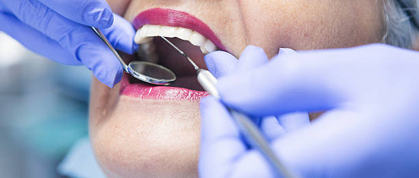 Best Walk-In Emergency Dentist in Horicon, WI